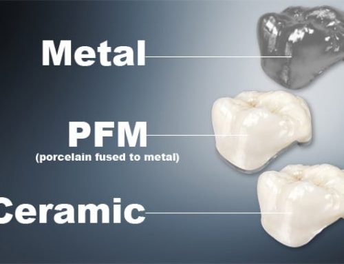 New choice of tooth